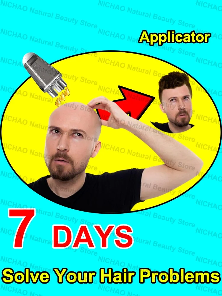 

7 Days Fast Hair Growth Essential Loss Regrowth Treatment Strengthens Hair Nourishes Scalp Light Weight Non Greasy