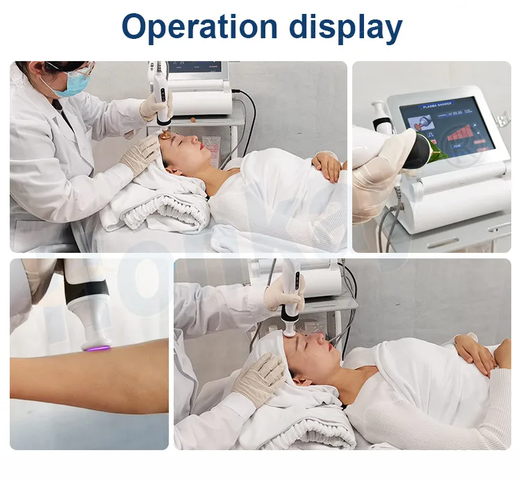 Bolígrafo iónico, pulverizador de plasma frío, ajuda a reafirmar la piel, regenerarla, eliminar el acné e levantar los párpados.
