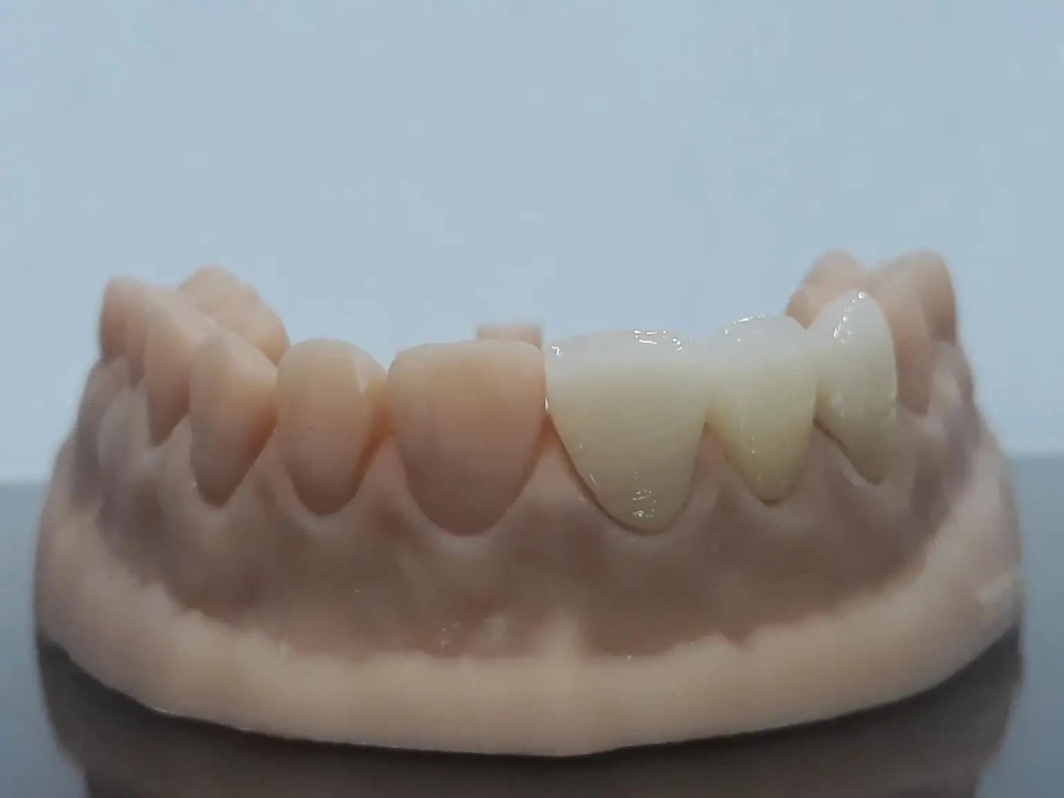 SHT Preshade Zirconia Block Vita 16 لونًا جميع المؤشرات متوافقة مع نظام الطحن CAD/CAM المواد الفنية