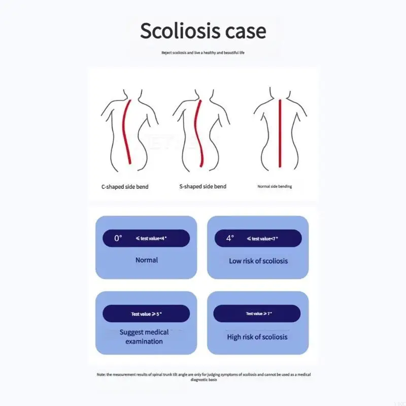 Scoliosis Testing M…