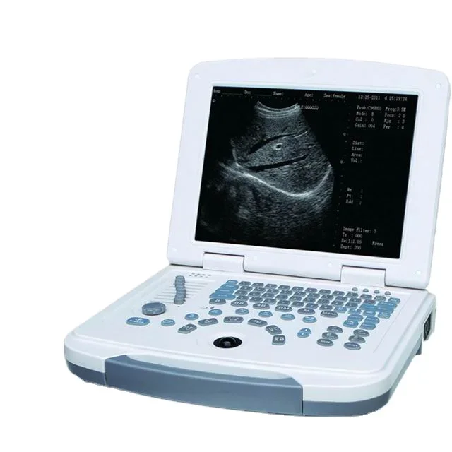 

Ultrasound scanner laptop full digital pet ultrasound machine echographie portable veterinary ultrasound