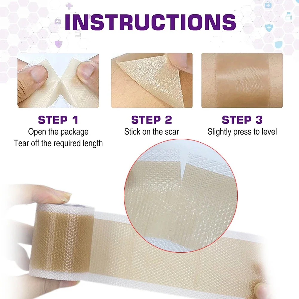 1Roll Professional Silicone Scar Sheets Scars Treatment - Reusable Silicone Scar Strips Type for Keloid, C-Section, Surgery,Burn