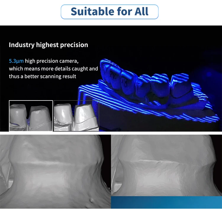 Zhndent-3D Scanner Dental, Produtos, Baixo Preço, Equipamentos Odontológicos