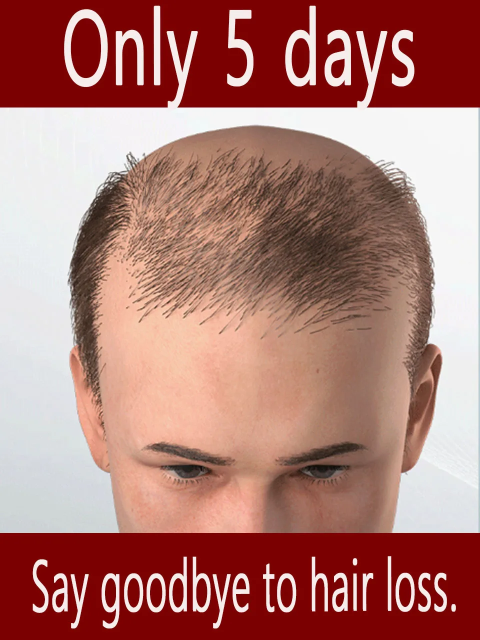 

Say goodbye to hair M-shaped,.Generation-2,to solve hair problems and protect your scalp health,care tool,Unisex,free shipping.