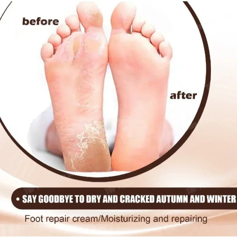 Horse Oil Anti Crack Foot Cream Anti-Drying Heel Cracked Moisturizing Repair Hand Lotion Anti-Aging Nourishing Smooth Skin Care