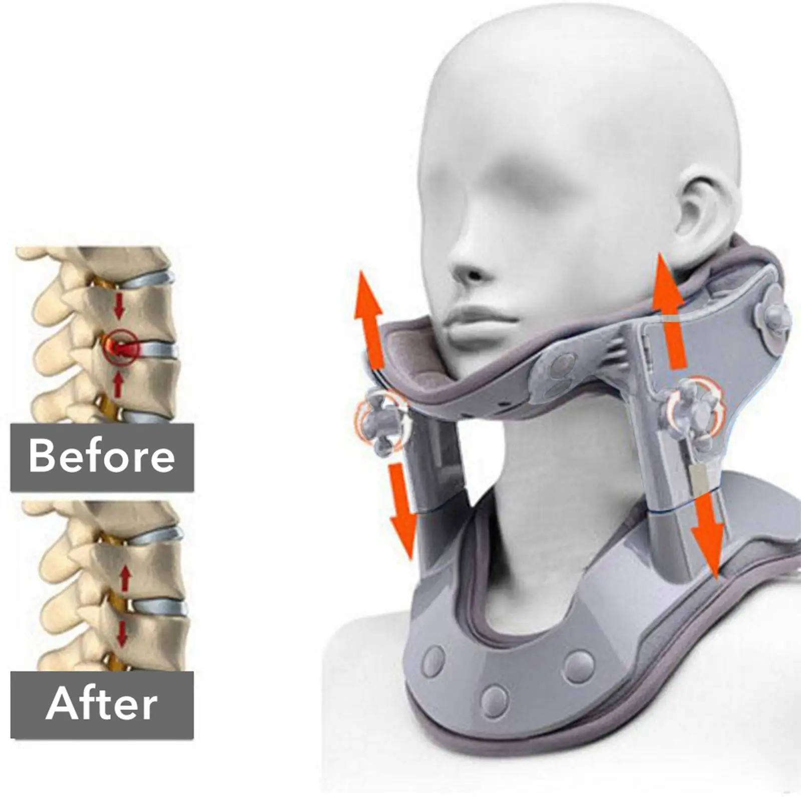 

Adjustable Cervical Neck Traction Device for Relief and Improved Alignment - Enhanced Design