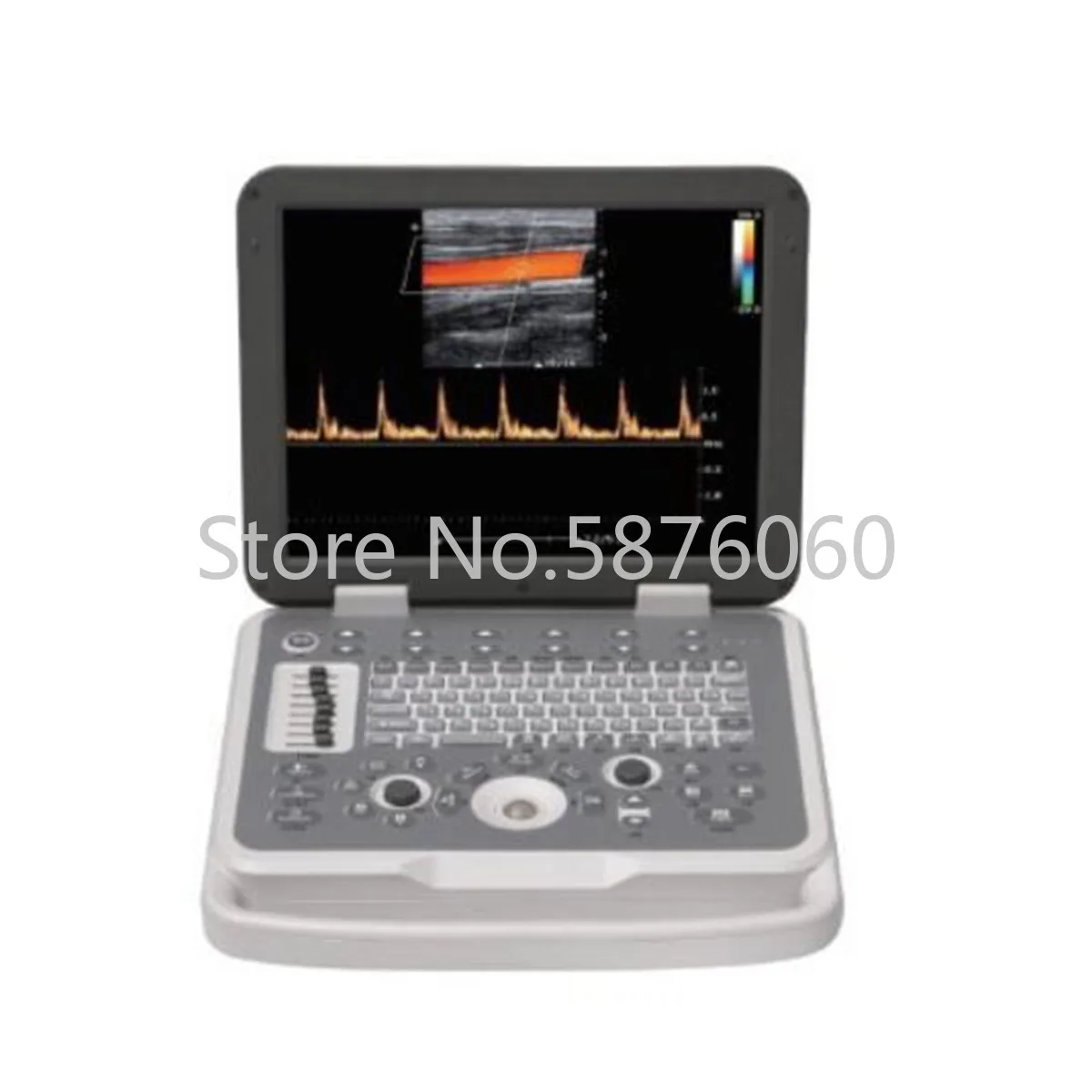 Human Colorful Doppler Ultrasound Clinic and Hospital Laboratory Diagnosis Medical Machine