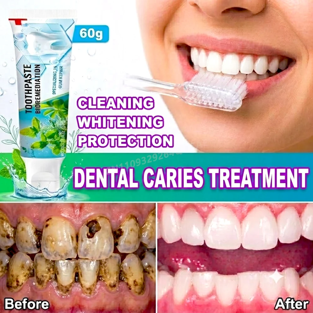 Whitening Toothpaste for Sensitive Teeth and Gums