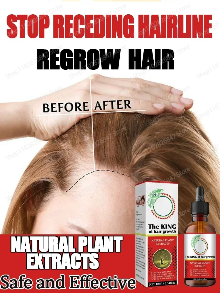 

Biotin Fast Hair Growth Oil Hair Regrowth Serum aHair Thinning Treatment aHair Growth Liquid Anti-Hair Loss for Women and Men