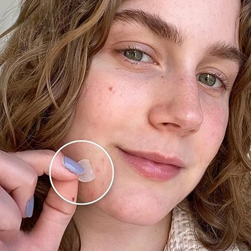 360개 라운드 투명 여드름 패치 스킨케어 스티커 메이크업 도구