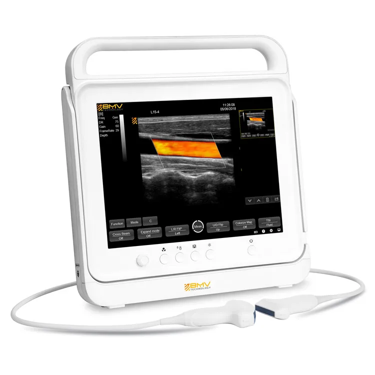 Touch Screen 15