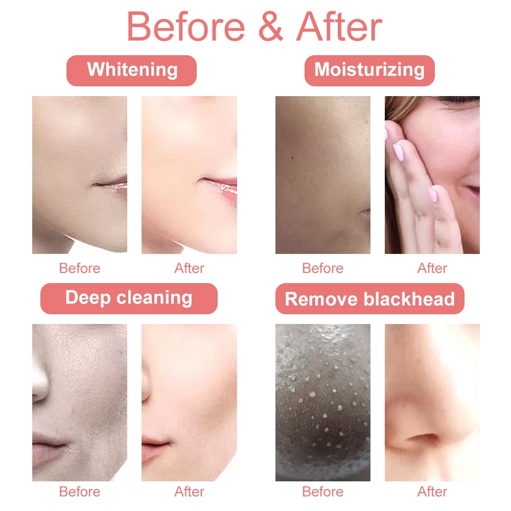 7-in-1 professionele schoonheid gezichtsmachine Hydra Aqua Diep reinigend huidverzorgingsapparaat H2-O2 Hydro Dermabrasie RF Bio-lifting