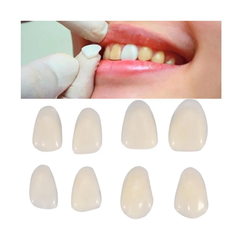 1 Pack A1 A2 A3 Shade Dental Utra-Thin SYnthetic Resin Teeth Whitening Veneers Upper&Lower Anterior Composite Dentist Materials