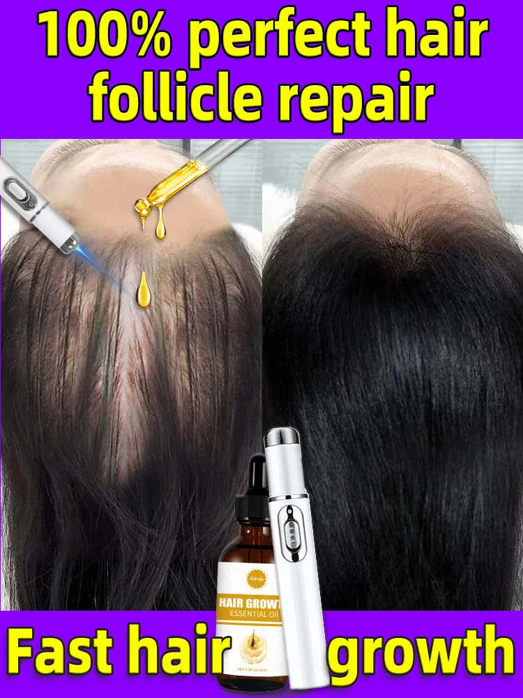 Laser repair of scalp follicles to promote rapid hair growth