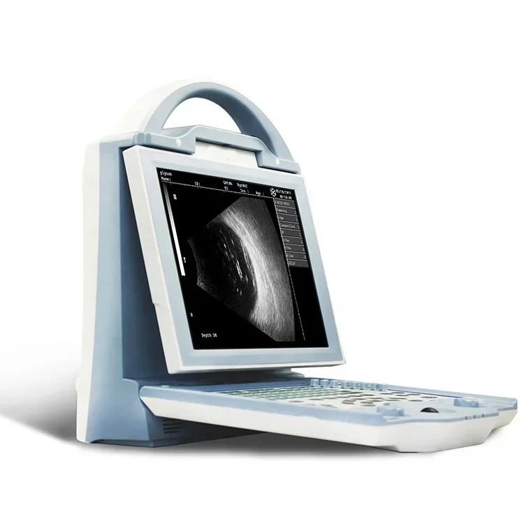 ODU-5 China Manufacturer Price Eye Diagnostic Scan Ultrasound for Ophthalmology