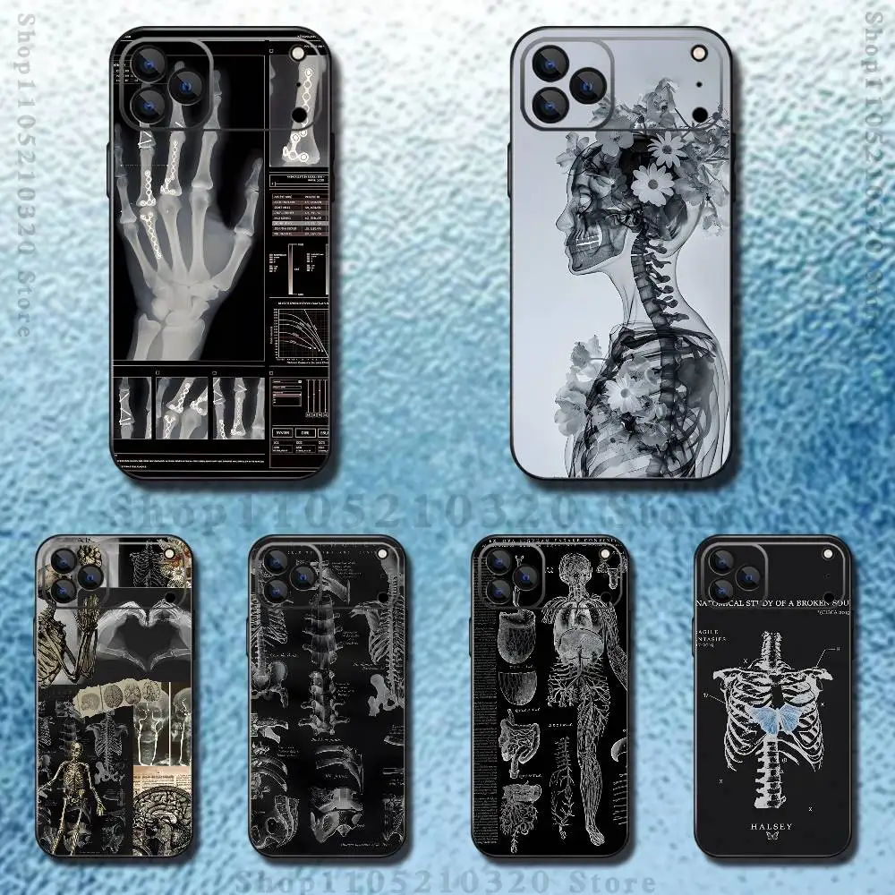 

human organs Skeleton Phone Case For iPhone 17,16,15,14,13,12,11,Pro,Max,Plus,E,SE4,Air,Mini Black Soft Funda