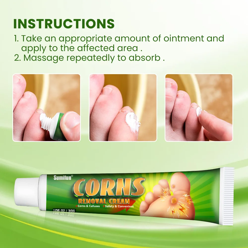 Foot Corn Remover Cream Chicken Eye Skin Infection Treatment Ointment Feet Dead Skin Calluses Removal Tool Health Care 내성발톱