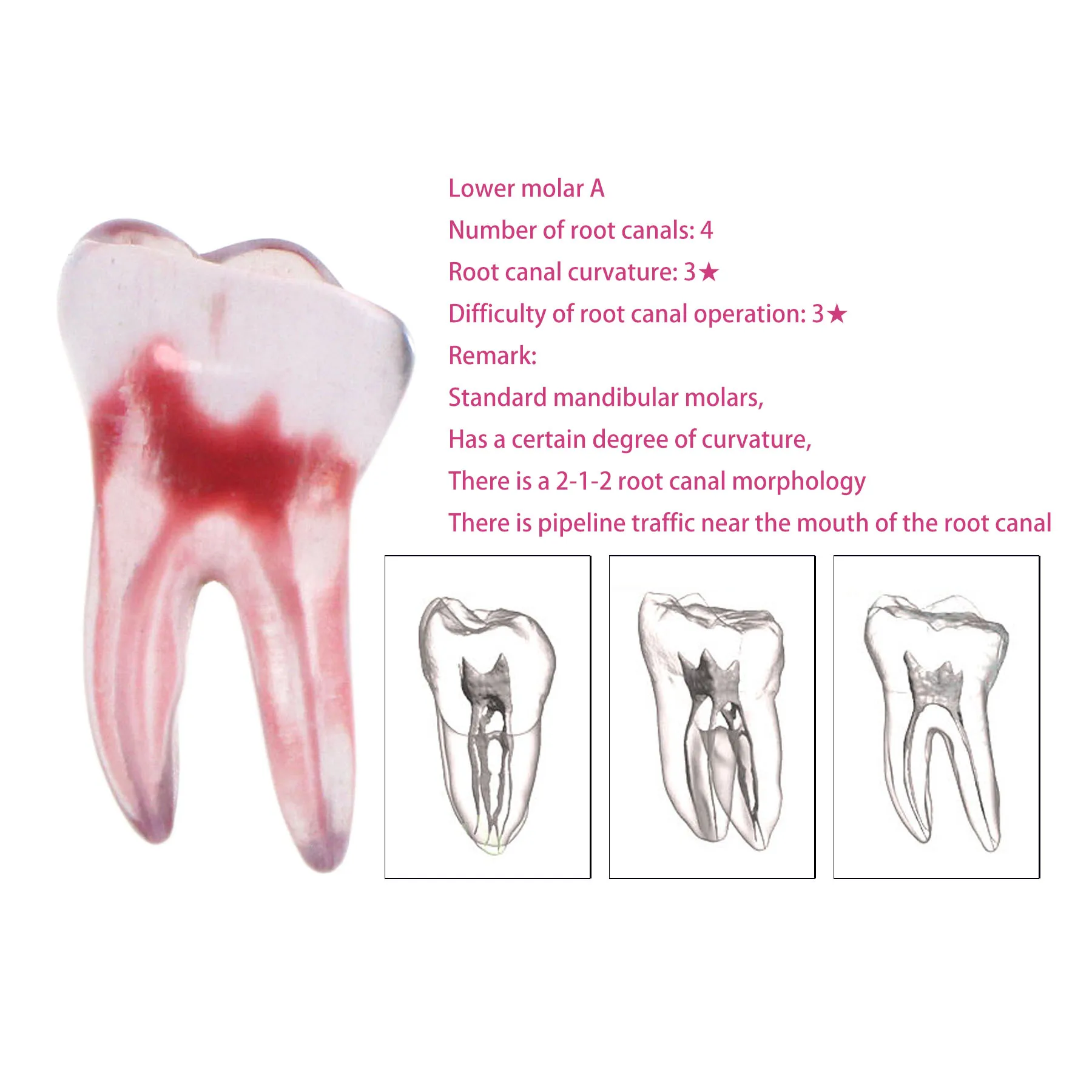 

Dental RCT Endo Training Teeth Model 3D Curved Root Resin 1:1 Endodontic Education Cavity Lower Molar A