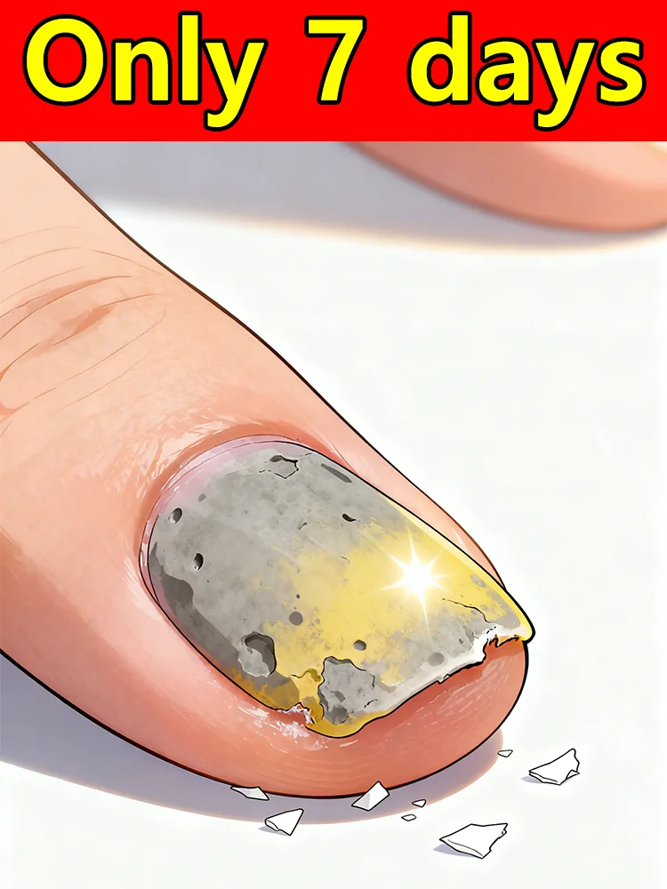 

Ежедневное средство для восстановления ногтей для улучшения внешнего вида