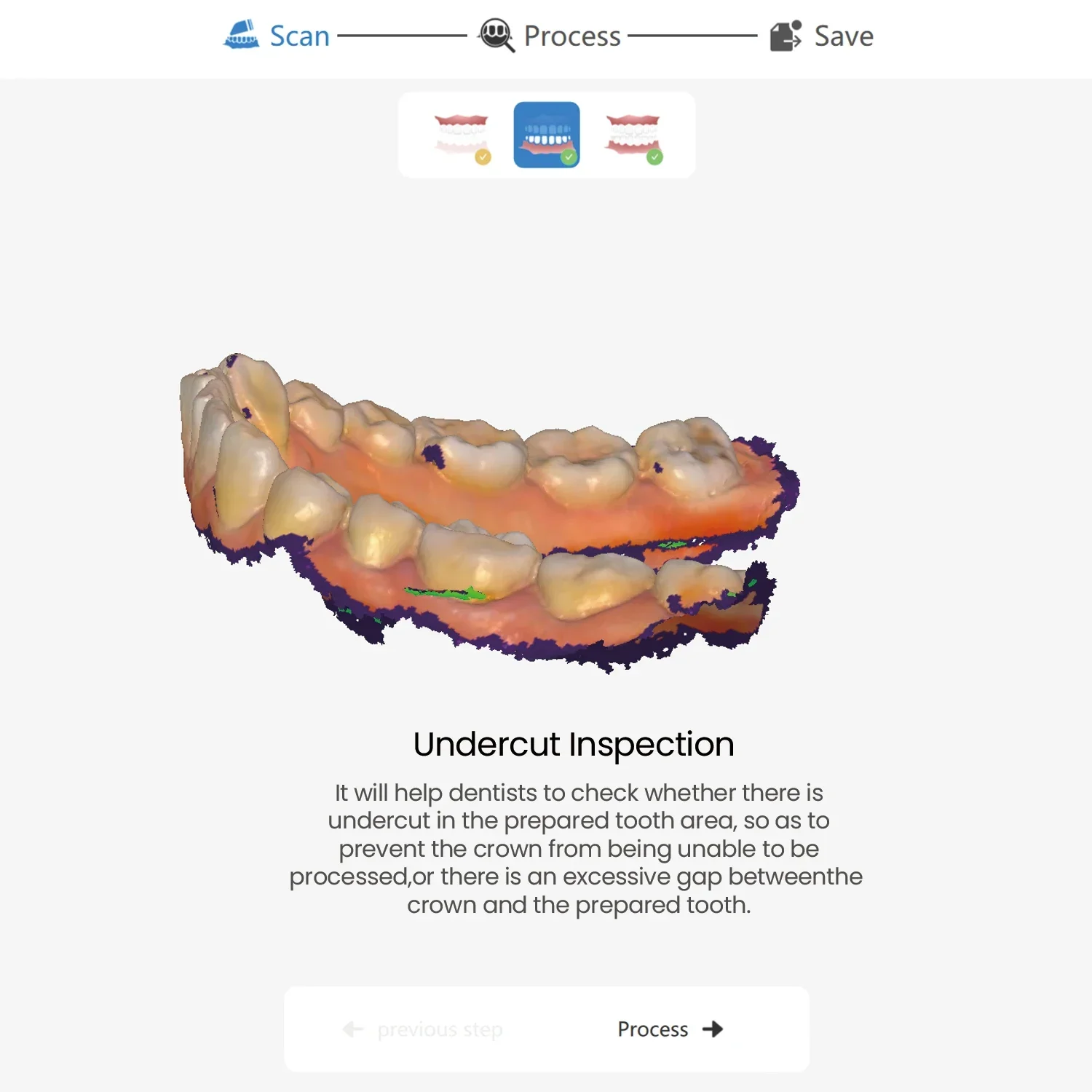 Scanner 3D dentale Lodden Heyinscan S3 con software di scansione CAD CMD Display in tempo reale Attrezzatura per fotocamera orale intraorale