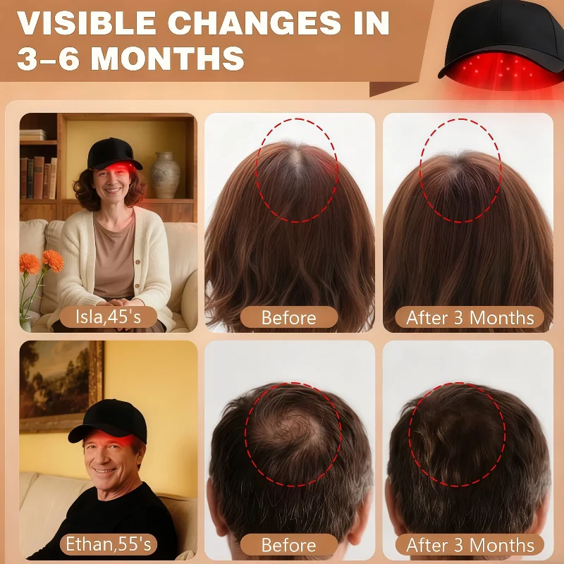 

96 Diode Laser Cap for Baldness Treatment and Thinning Hair LLLT Hair Regrowth Therapy Device