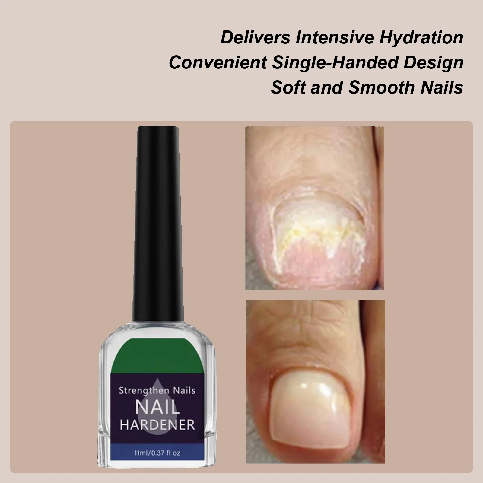 solucao-para-cuidados-com-as-unhas-11ml-fortalece-e-ilumina-as-unhas-endurecedor-natural-solucao-para-unhas-para-pes-amarelos-cuticula-dedo-do-pe-pedicure