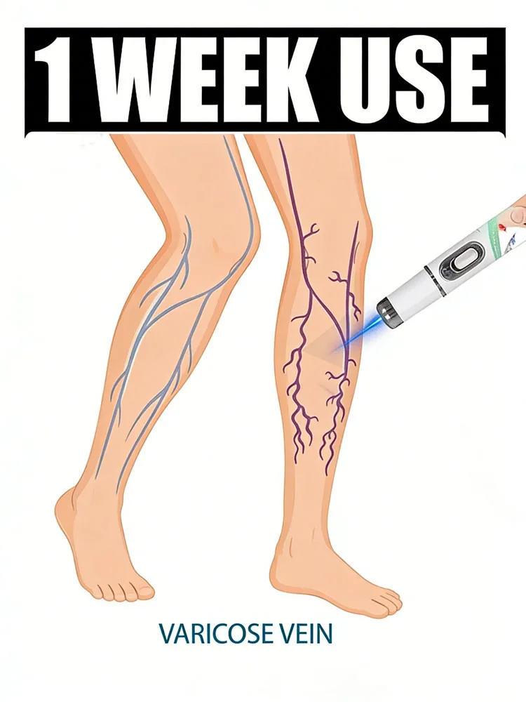 

Инструмент для ухода за ногами Blue Light Pen поможет вам попрощаться с дискомфортом в ногах.