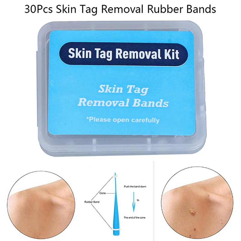 20pcs Care Tools Skin Tag Removal Rubber Bands Micro Band Non Toxic Face Care Mole Wart Skin