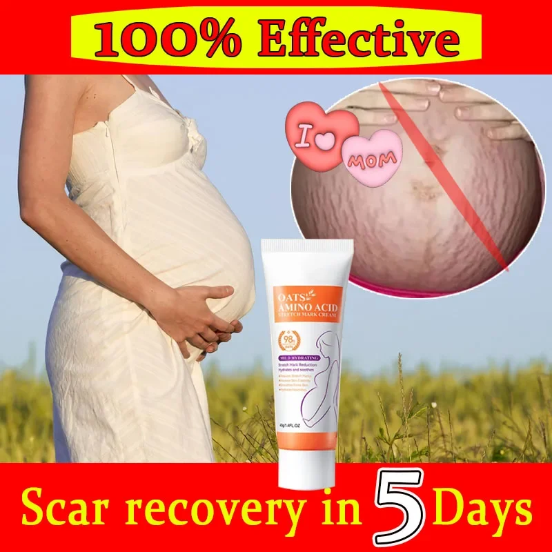 

Scar Repair Cream Anti Wrinkle Anti Aging Maternity Skin Repair Remove Pregnancy Surgical Scars Treatment Body Skin Care Cream