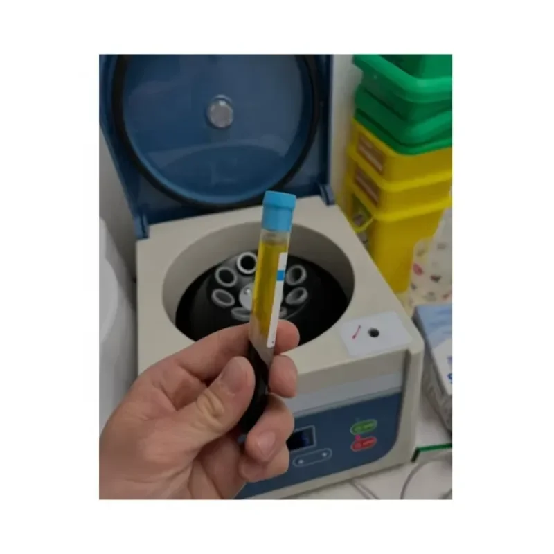 Modern Medical 2026 Laboratory Centrifuge Machine for Platelet Rich Plasma Tube Separation High Speed Clinical Lab