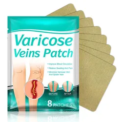 Parche médico ZK30 para venas varicosas, parche para eliminación de angitis, Vasculitis, flebitis, pierna Araña, 8 piezas
