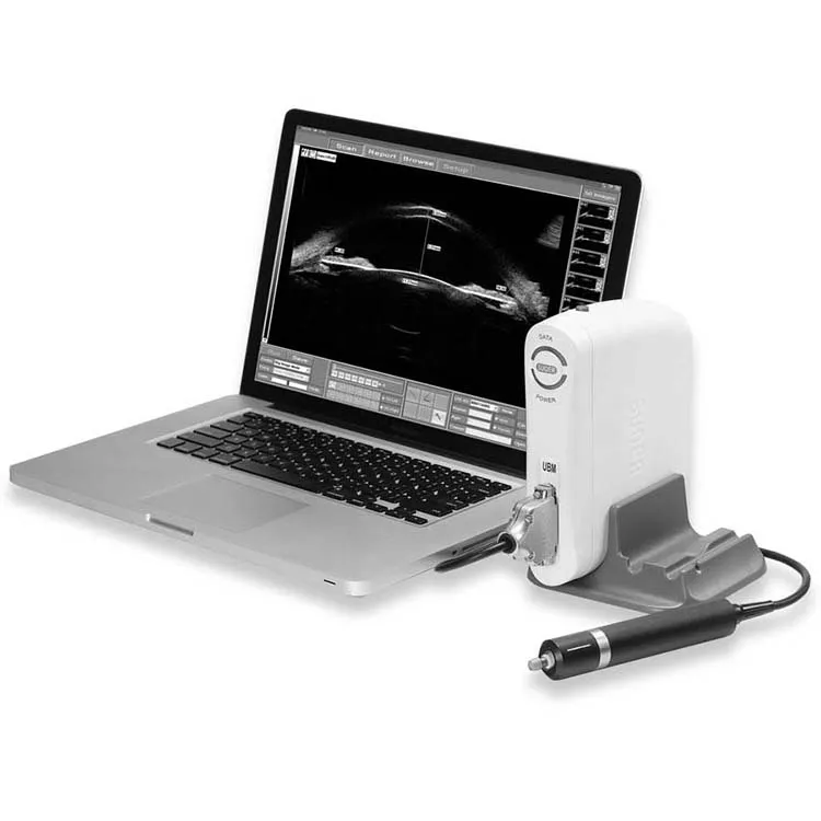 YSSW-2100 Ophthalmic Ultrasound A/B Scan Unit Ophthalmic Ultrasound Scanner