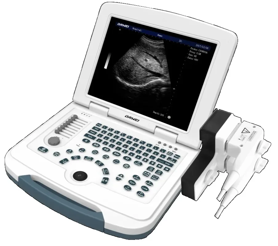 b/w ultrasound machine digital  for obstetrics and gynaecology