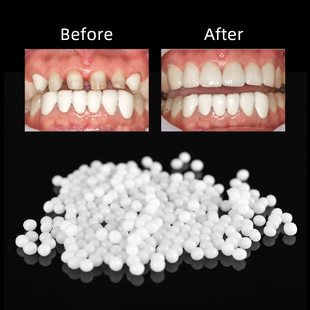 

100g Tooth Solid Gel Temporary Repair Kit Mouldable Thermal Fitting Bead Teeth Pellet Adhesive Fake Teeth for Halloween Scary