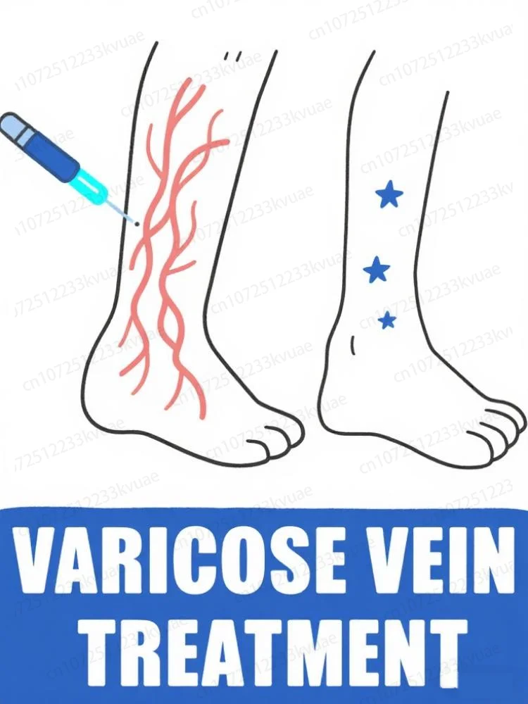 

Vᴀʀɪᴄᴏsᴇ ᴠᴇɪɴ ʟᴀsᴇʀ ɪɴsᴛʀᴜᴍᴇɴᴛ