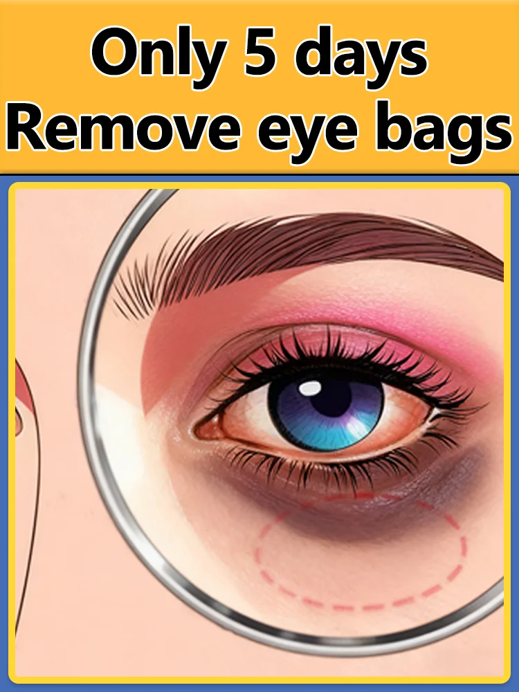 

Фокус на перисторбиталическом уходе 100% эффективно для удаления мешков под глазами.