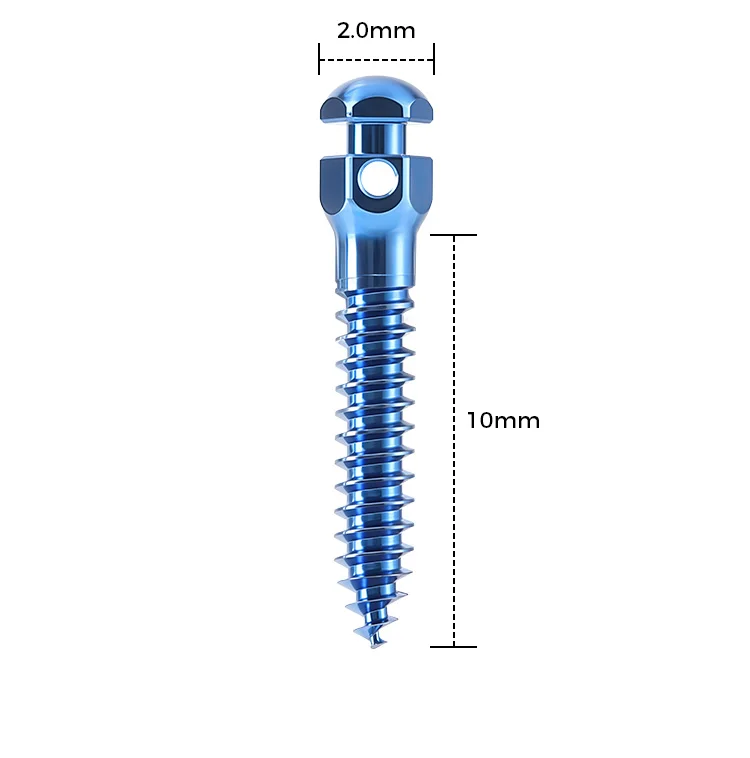 AZDENT Dental Orthodontic Mini-Schraube Sterile Titanlegierung Selbstbohrende Gewindeschrauben Implantat-Mikroschrauben Zahnmedizin – Detail 9