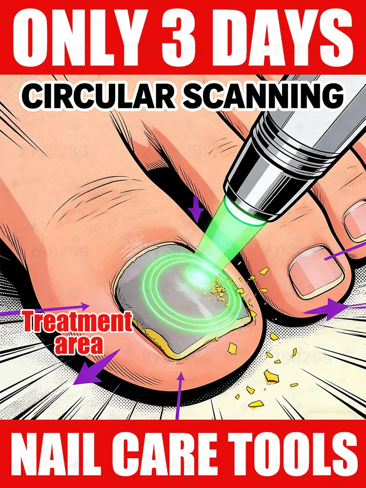 

2025 NEW Blue light laser pen ᵗʰᵒʳᵒᵘᵍʰˡʸ ʳᵉᵐᵒᵛᵉˢ ᶠᵘⁿᵍⁱ⸴ ᑫᵘⁱᶜᵏˡʸ ᵉˡⁱᵐⁱⁿᵃᵗᵉˢ ᶠᵘⁿᵍⁱ⸴and restores nail health.