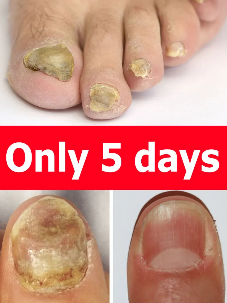 Nägel werden wunderschön