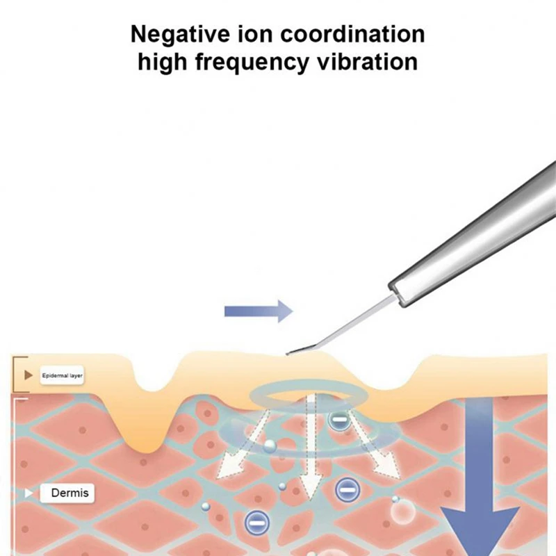 Instrument de beauté pour nettoyer les pores, Ion Peeling, lumière rouge et bleue, thérapie photonique LED, élimine les points noirs