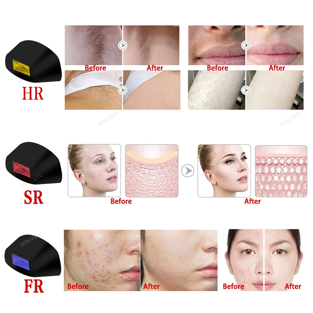 900000Flashes Laser Epilator dropshipping Hot Sell Permanent IPL Photoepilator Hair Removal Painless Electric Epilator Machine