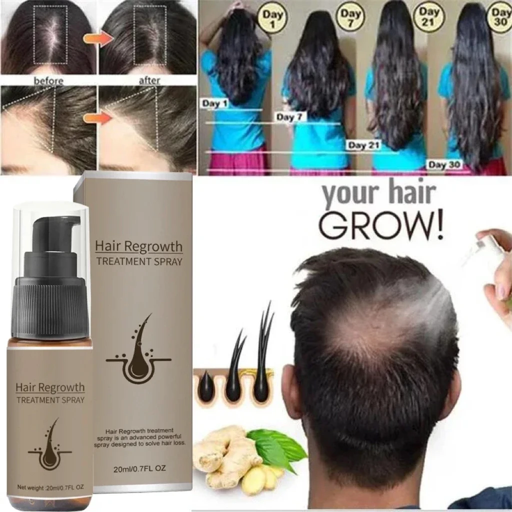 Serum penumbuh rambut pria wanita, produk perawatan rambut rontok Anti jahe semprot penumbuh rambut kuat, menutrisi akar rambut cepat