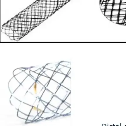 2026 Medical Surgical Pet Hospital Clinic Veterinary Dog/ Cat can Use EO Sterilized Nitinol Veterinary Tracheal Stent  High qual