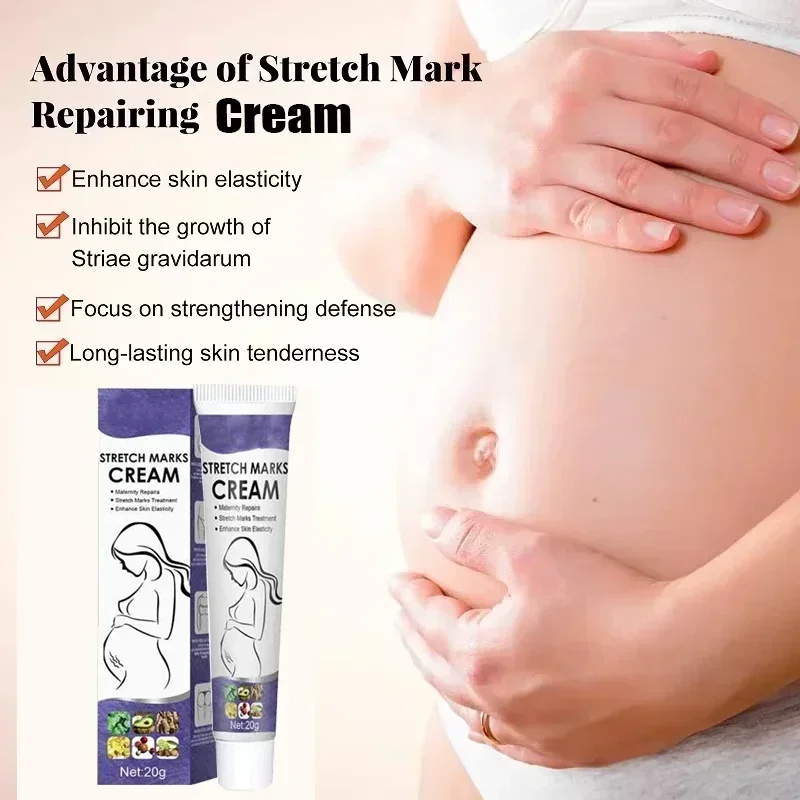 Stretch Mark Vanishing Cream Remove Body Buttock Breast Marks Effective Repair Maternity Loose Firming Skin Care