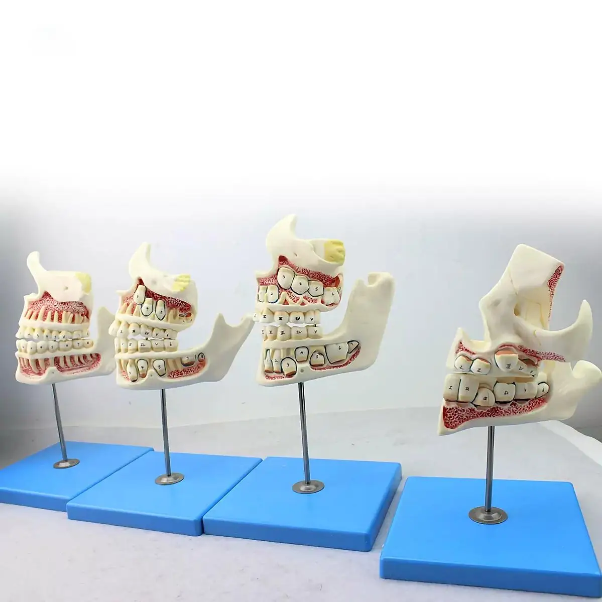 Set Human Development Stage From Deciduous To Permanent Teeth Oral Cavity Dentist Dental Surgeon Model Medical Teaching Models