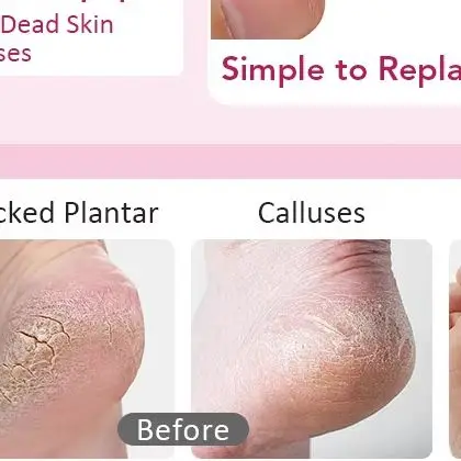 

Electric Pedicure File Machine Dead Skin Remover Callus Foot Grinding Trimmer Foot Care Tool Scrubber USB Charge