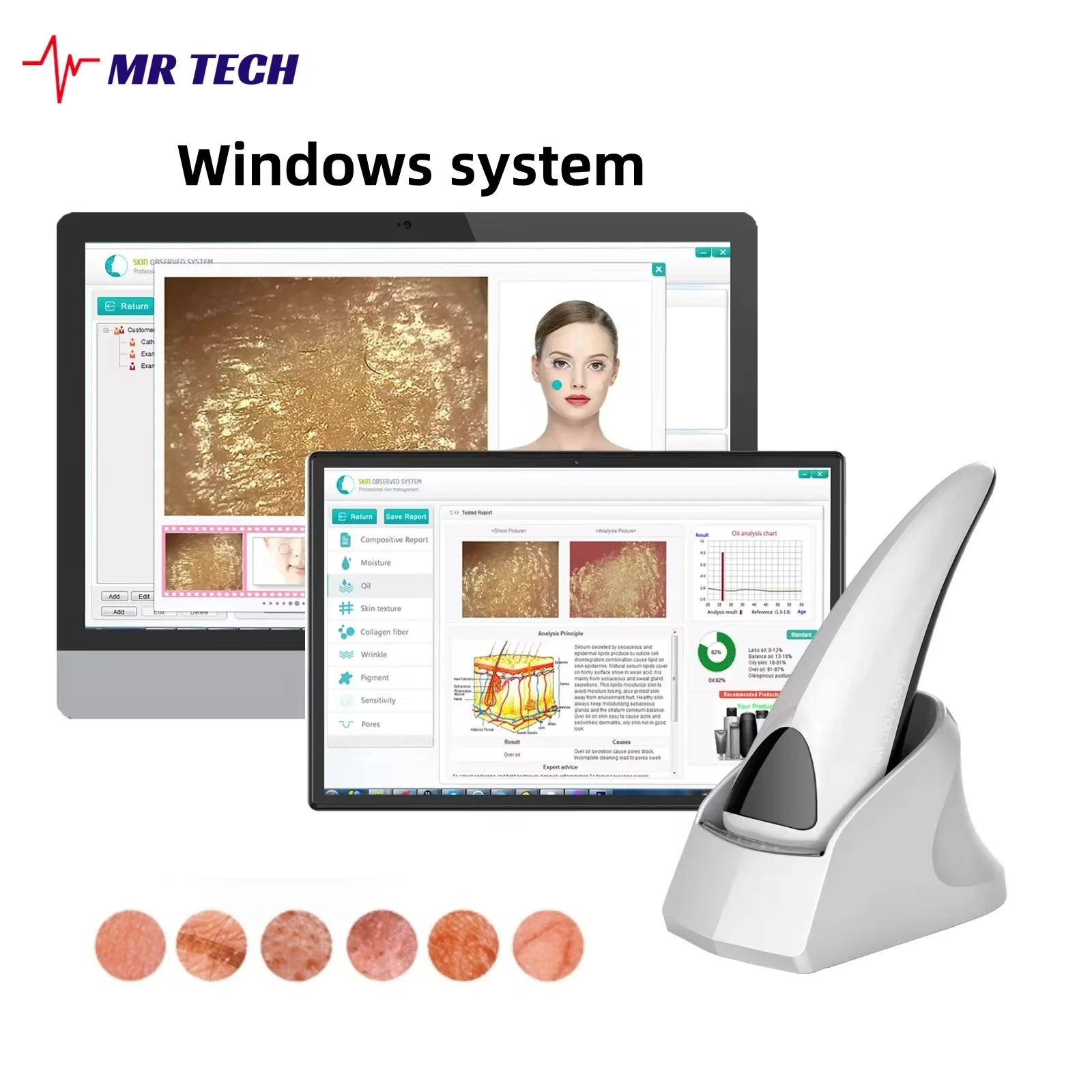 High-Definition Pixel Draagbare Esthetische Huidanalysator Automatische Diagnose Gezichts Epidermis Huidmicroscoop Salon Schoonheid