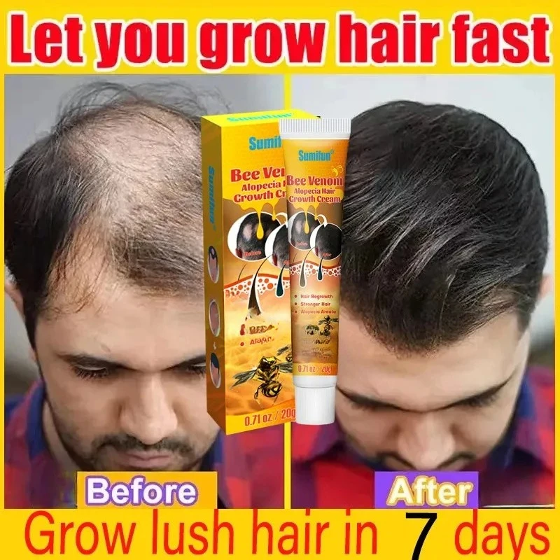 

Hair Growth Cream 7 Days Fast Regrowth Essential Capsule Anti Hair loss Baldness Repair Damaged Scalp Treatment For Women Men