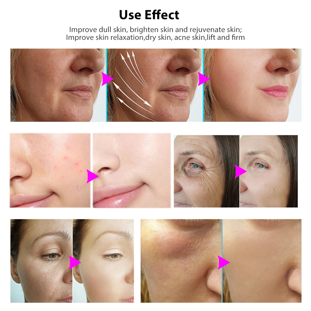 Hifu 고주파 얼굴 리프팅 마사지기, 피부 회춘, EMS 미세 전류 광자 이론, 얼굴 타이트닝, 안티 에이징 기계