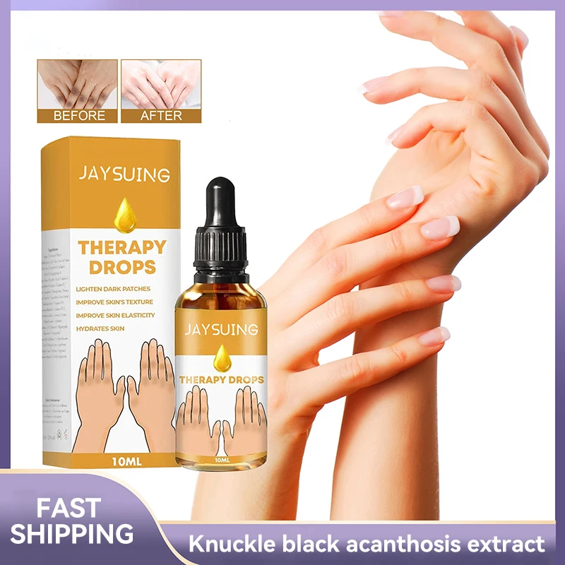 Dark Knuckles Fast Brighten Serum Knee Black Skin Quickly Lighten Stains Remover Essence Elbows Hand Knuckle Brightening Serum